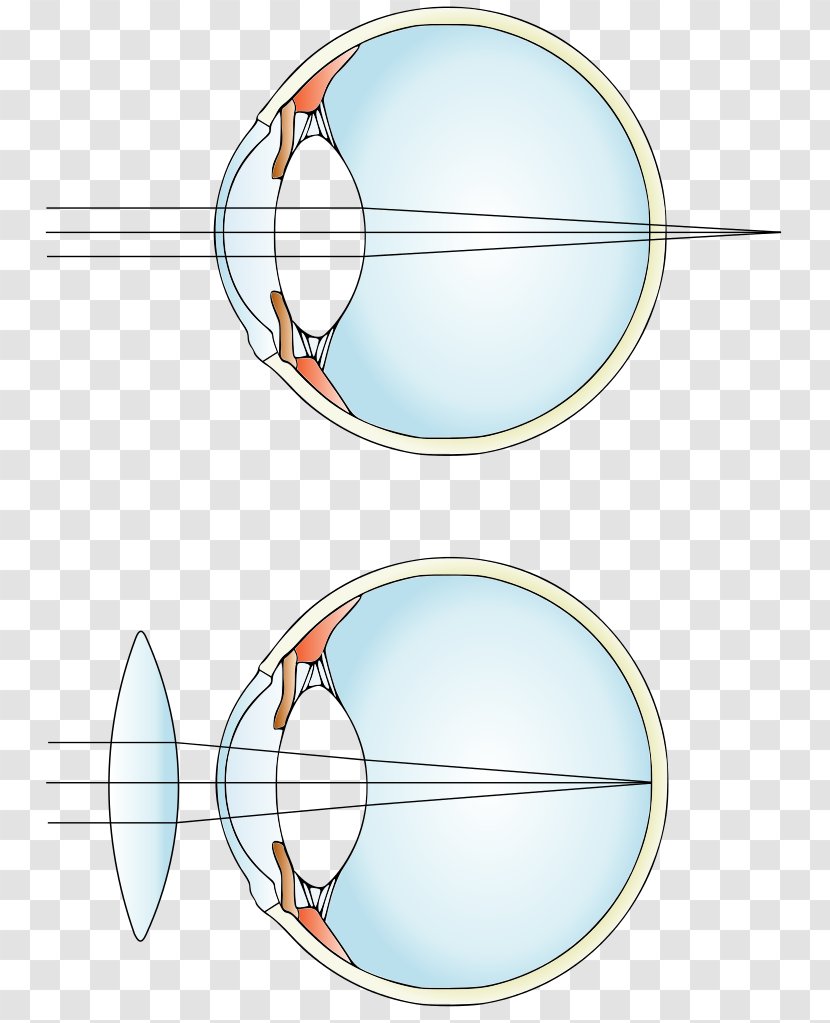 Far-sightedness Near-sightedness Corrective Lens Eye - Visual Perception Transparent PNG