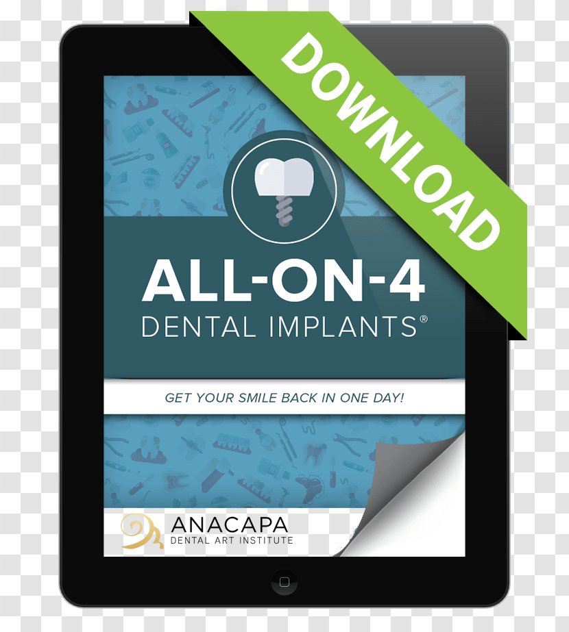 All-on-4 Dental Implant Dentist Tooth Bellevue Care & Center - Blue - Implants Transparent PNG