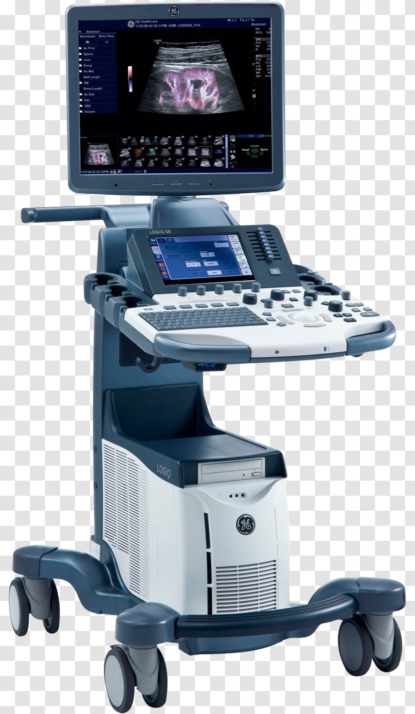 Voluson 730 Ultrasonography Ultrasound Medicine GE Healthcare - Health Care - Doppler Echocardiography Transparent PNG