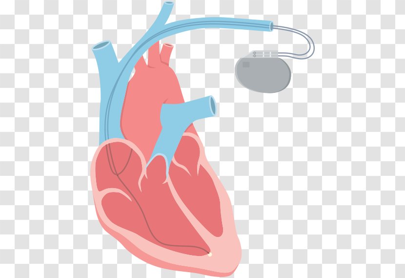 Heart Arrhythmia Clip Art Tachycardia Catheter Ablation - Watercolor - Beat Faster Transparent PNG