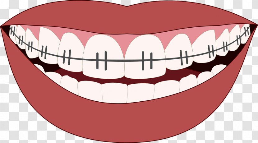 Cosmetic Dentistry Orthodontics Dental Implant - Tree - Orthodontist Transparent PNG