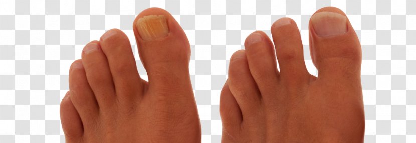 Nail Hand Model Thumb - Fingernail Foot Transparent PNG