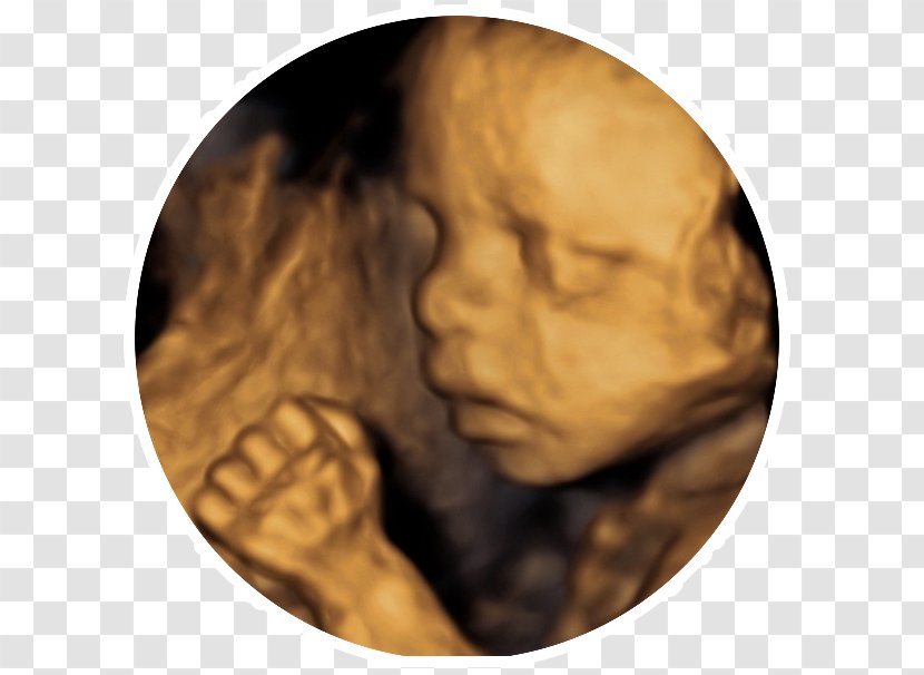 Cabinet Medical Obstetrica-ginecologie Dr.serbanoiu Voluson 730 3D Ultrasound Ultrasonography 4D-Ultraschall - Obstetrics And Gynaecology - Leep Transparent PNG