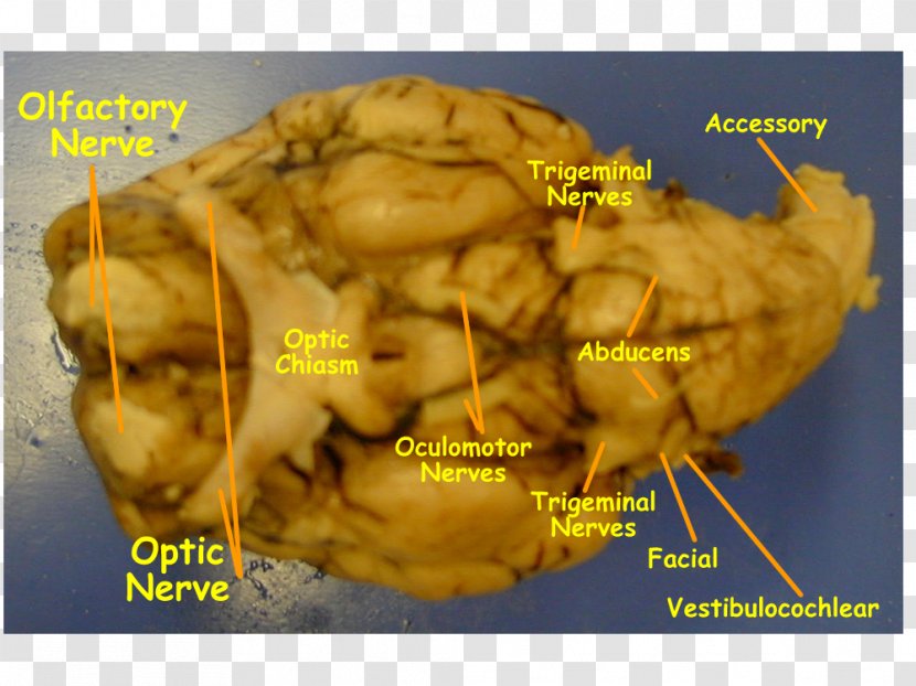 Sheep Cranial Nerves Brain Hypoglossal Nerve Olfactory - Medulla Oblongata Transparent PNG