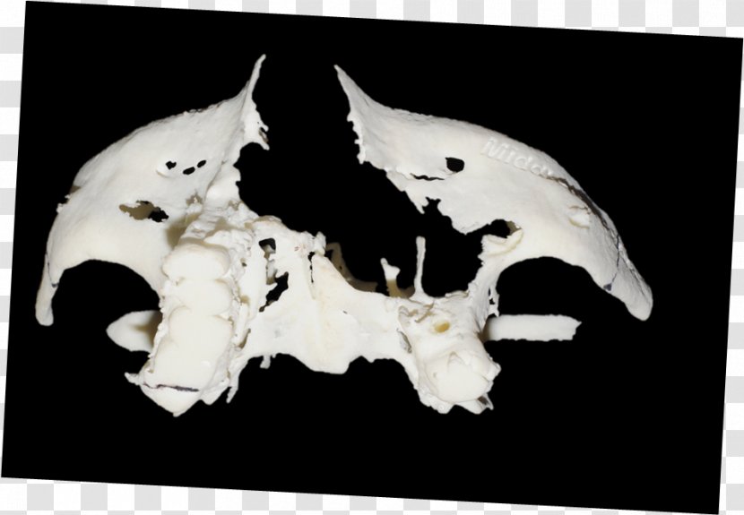 Palatal Obturator Oroantral Fistula Printing Maxillary Sinus Free Flap - Dental Implant - Skull Transparent PNG
