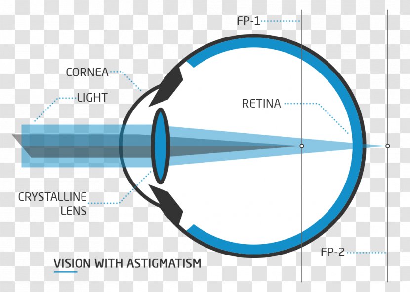 Floater Presbyopia Visual Perception Nd:YAG Laser Eye - Astigmatism - Test Transparent PNG