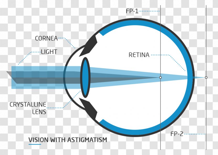 yag laser eye