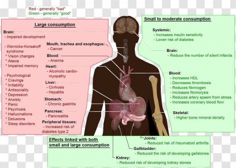 Alcoholism Long-term Effects Of Alcohol Consumption And Health Adverse Effect Alcoholic Drink - Flower - Datura Transparent PNG