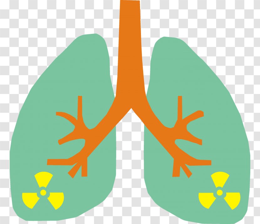 Lung Cancer Radon Smoking - Tobacco - Staging Transparent PNG