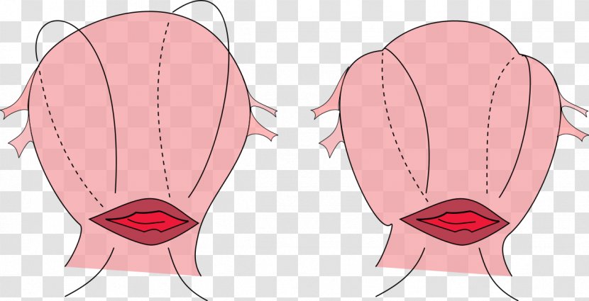 B-Lynch Suture Surgical Postpartum Hemorrhage Uterine Atony Uterus - Watercolor - Stitch Transparent PNG