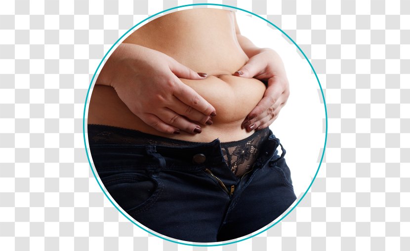 Abdominal Obesity Abdomen Weight Loss Cryolipolysis - Silhouette - Belly Fat Transparent PNG
