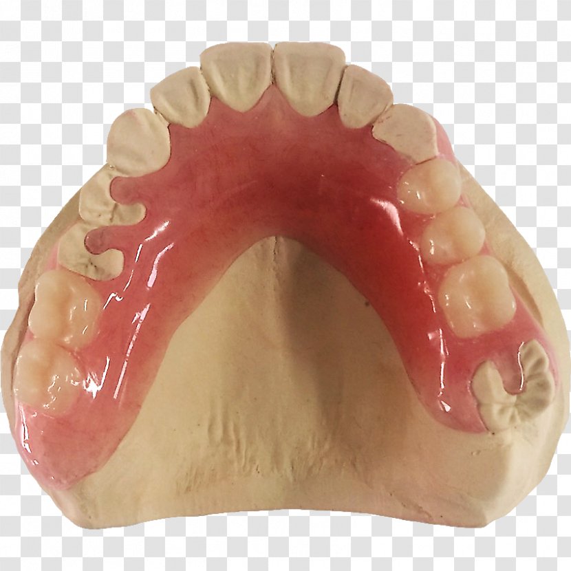 Human Tooth Dentures - Dental Laboratory Transparent PNG