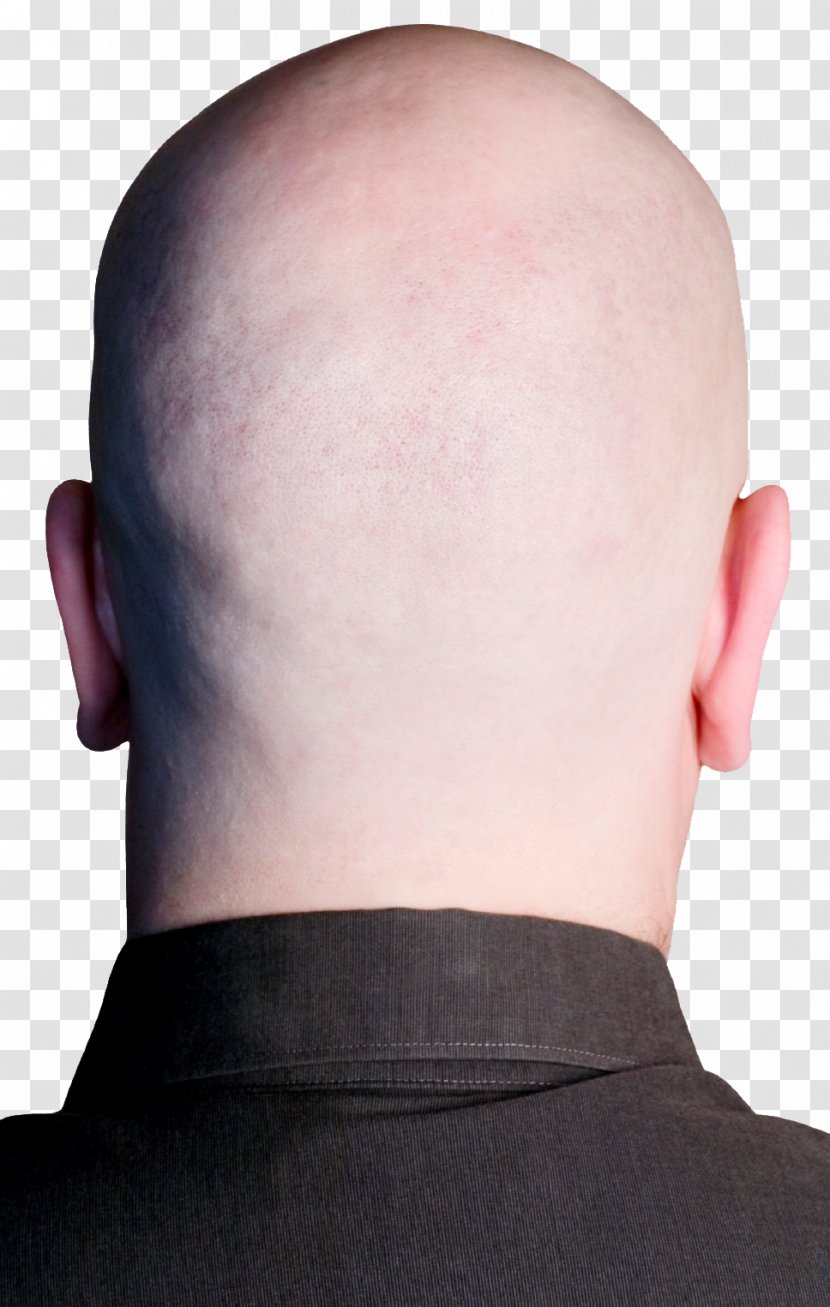 Forehead Chin Neck Hair Loss - Back Transparent PNG