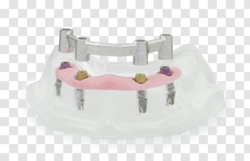 CAD/CAM Dentistry Computer-aided Design Manufacturing - Noble Metal Transparent PNG