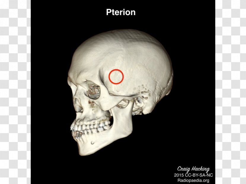 Anatomy Physical Therapy Skull Health - Bulletin Board Transparent PNG