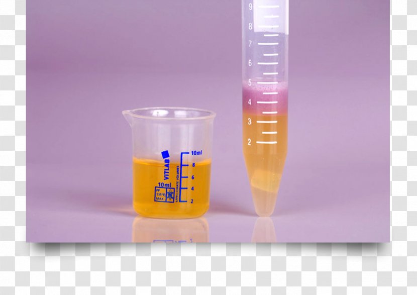 Clinical Urine Tests Drug Test Kidney Blood - Urinating Transparent PNG