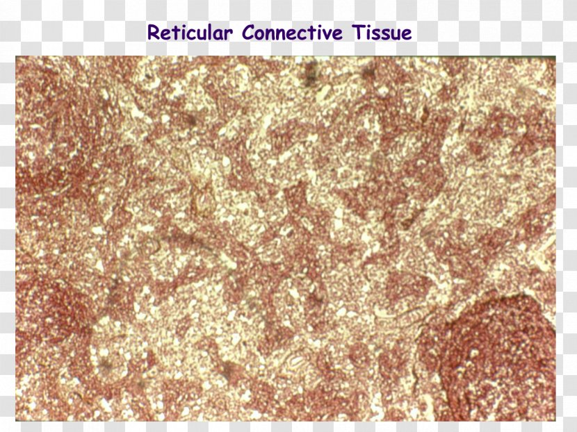 Reticular Connective Tissue Fiber Dense Irregular - Dermis - Ectoderm Transparent PNG