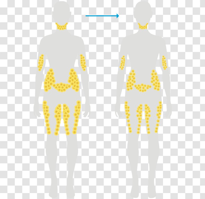 Cryolipolysis Weight Loss Dieting Adipose Tissue - Tree Transparent PNG