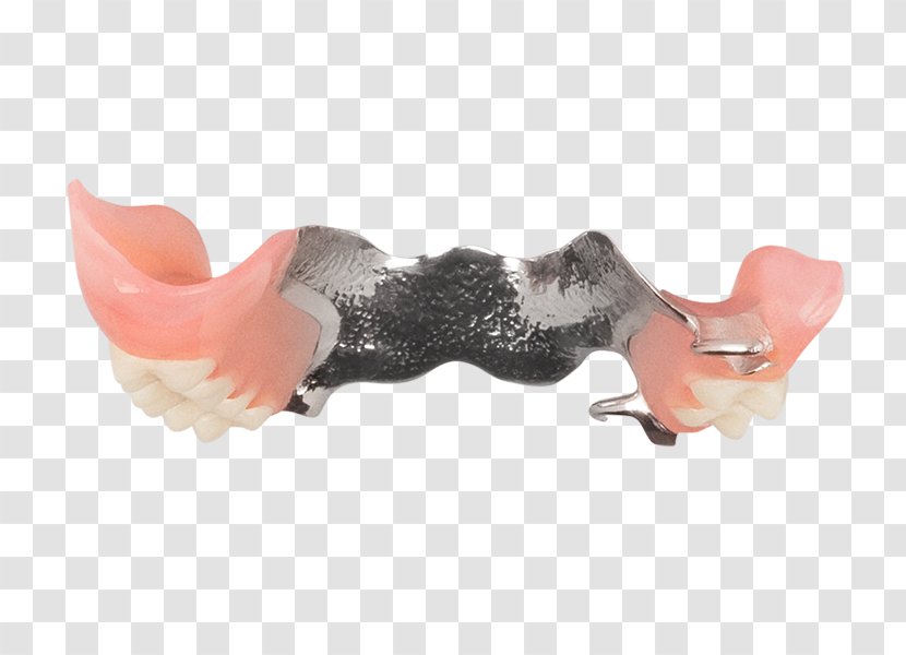 Removable Partial Denture Dentures Dentistry Aspen Dental Lazada Indonesia - Online Marketplace Transparent PNG
