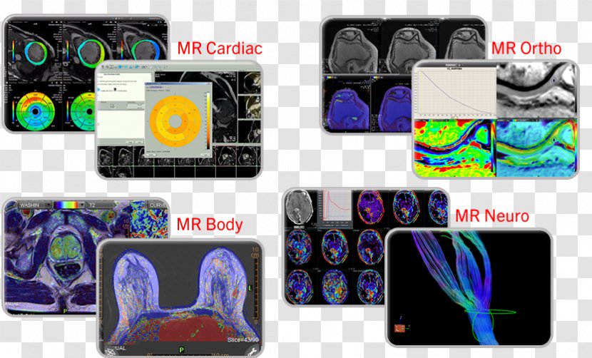 Nuclear Medicine Canon Medical Systems Corporation Magnetic Resonance Imaging Transparent PNG