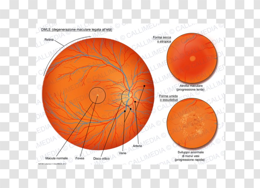 Macular Degeneration Macula Of Retina Old Age Atrophy - Presbyopia - Eye Transparent PNG