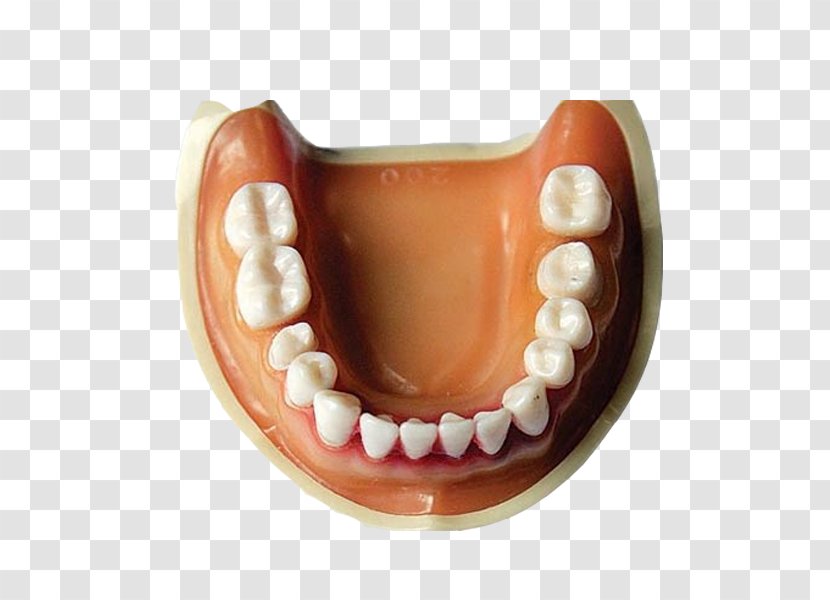 Tooth Dentures Mouth Prototype Crown - Health Beauty - Free Pull Material Transparent PNG
