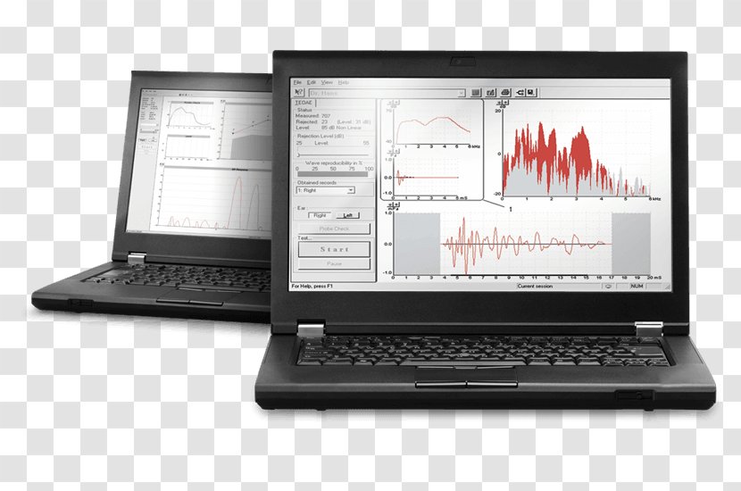 Otoacoustic Emission System Information Computer Software Digital Data - Multimedia - Brand Transparent PNG