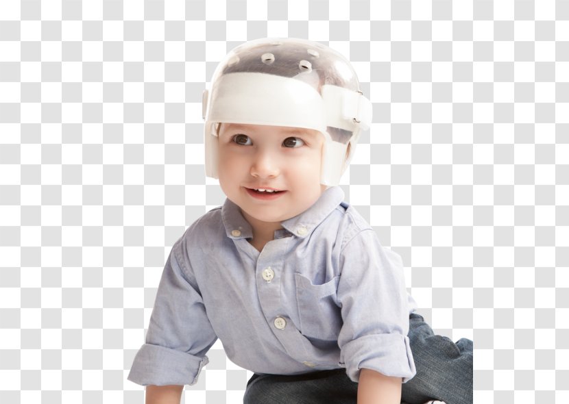 Orthotics Plagiocephaly Skull Pediatrics Child - Hard Hats Transparent PNG