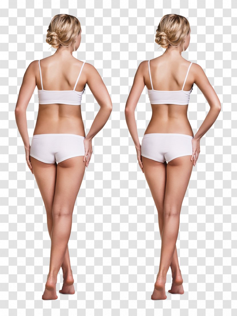 Weight Loss Model Adipose Tissue Fat Emulsification - Silhouette Transparent PNG