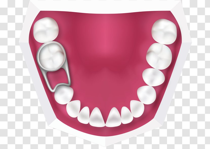 Tooth Deciduous Teeth Orthodontics Retainer Dentistry - Watercolor - Child Transparent PNG