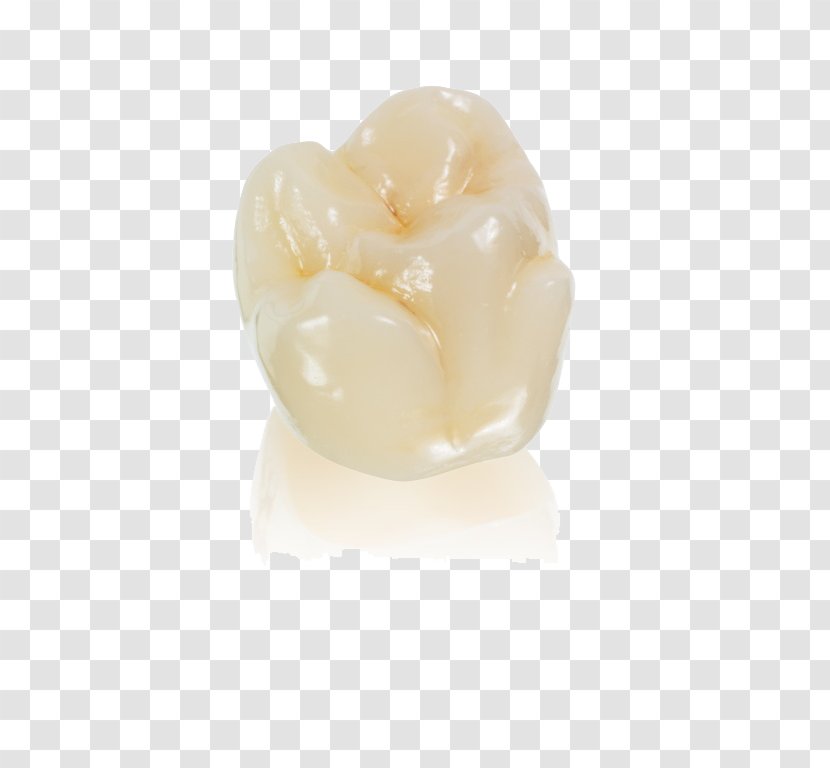 Vitallab - Occlusion - Dental Laboratory Crown Aesthetics Dentures ImplantCrystallize Transparent PNG