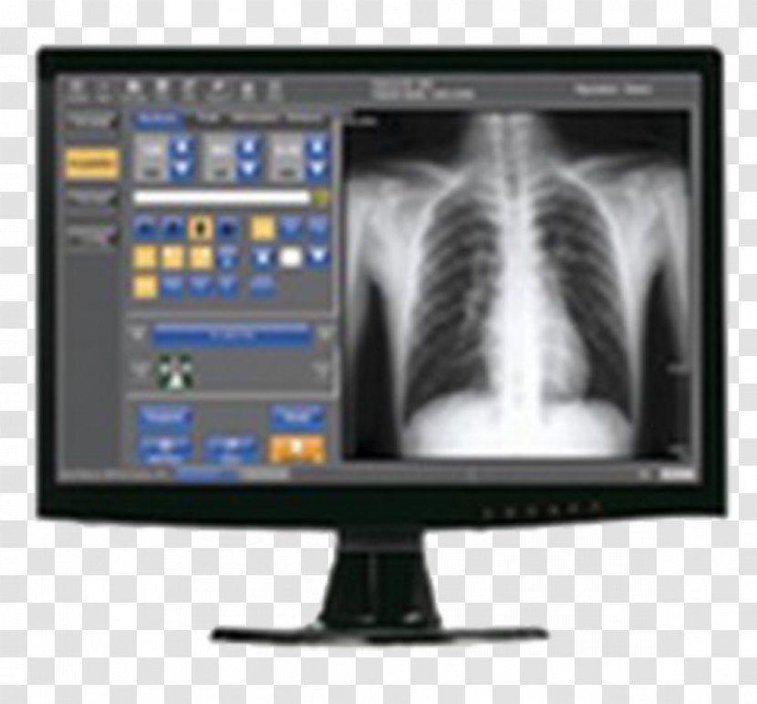 X-ray Digital Data Image Light Radiography - Computer Monitor - Rayos X Transparent PNG