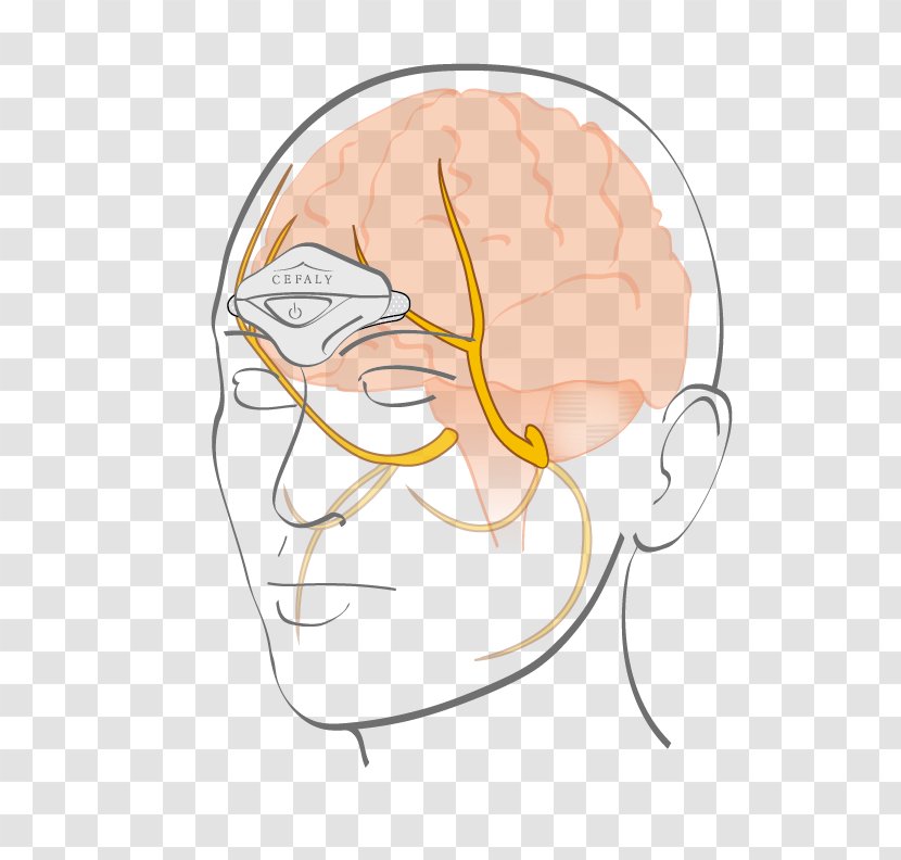 Cefaly Electrode Trigeminal Nerve Migraine Neuralgia - Frame - Neurostimulation Transparent PNG