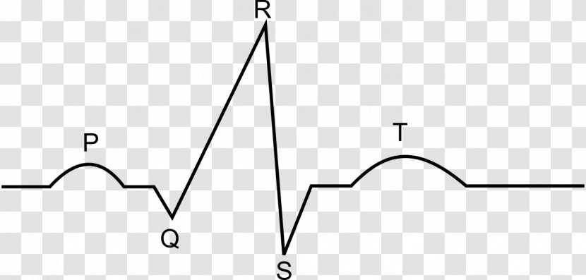 Electrocardiogram Electrocardiography Heart Medicine Drawing - Medical Emergency Transparent PNG