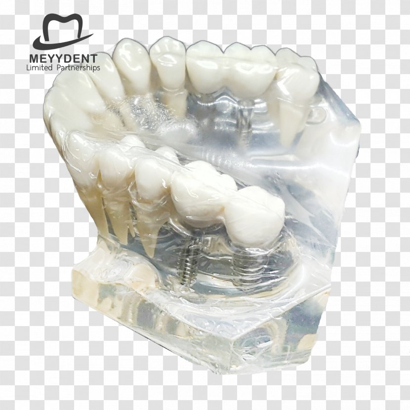 Human Tooth Dental Laboratory หจก.เมย์เด้นท์ Jaw - Gmail - Model Transparent PNG