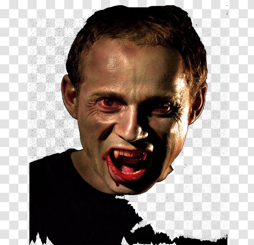 David Dolphin Porphyria Disease Vampire Clinical Vampirism - Surgery Transparent PNG