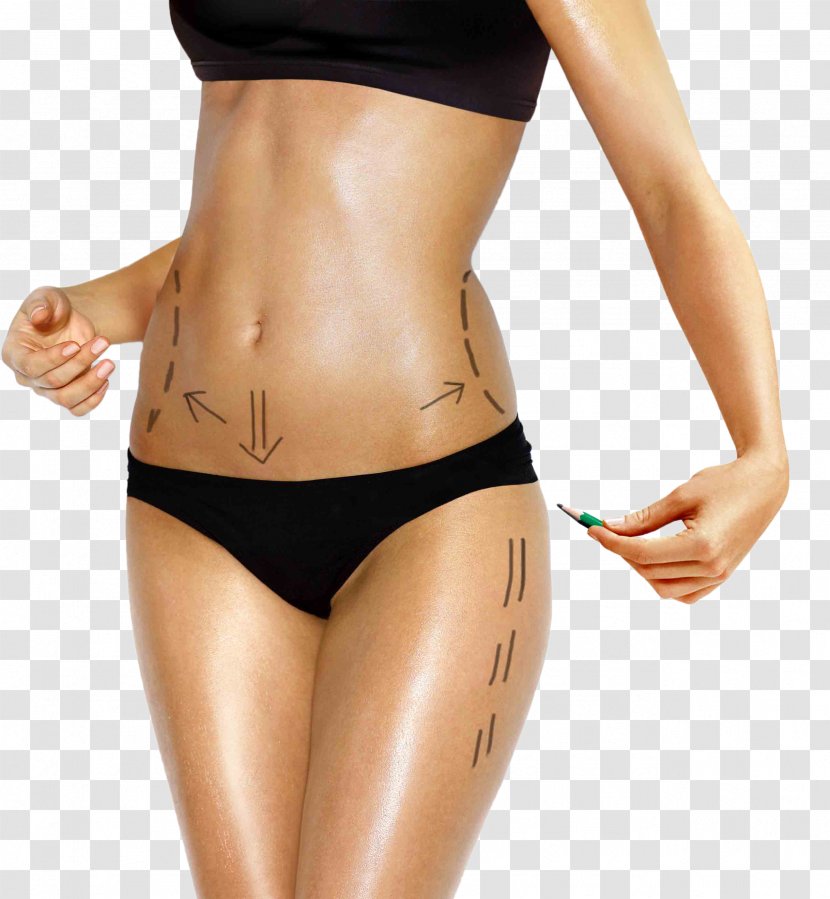 Body Contouring Liposuction Human Belt Lipectomy Surgery - Flower - Slim Transparent PNG