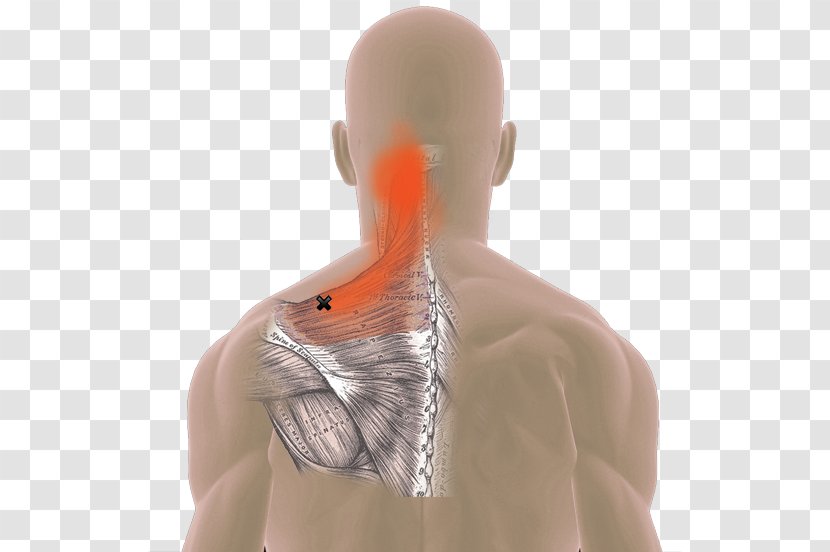 Neck Pain Myofascial Trigger Point Trapezius Muscle Spasm - Silhouette - Headache Transparent PNG