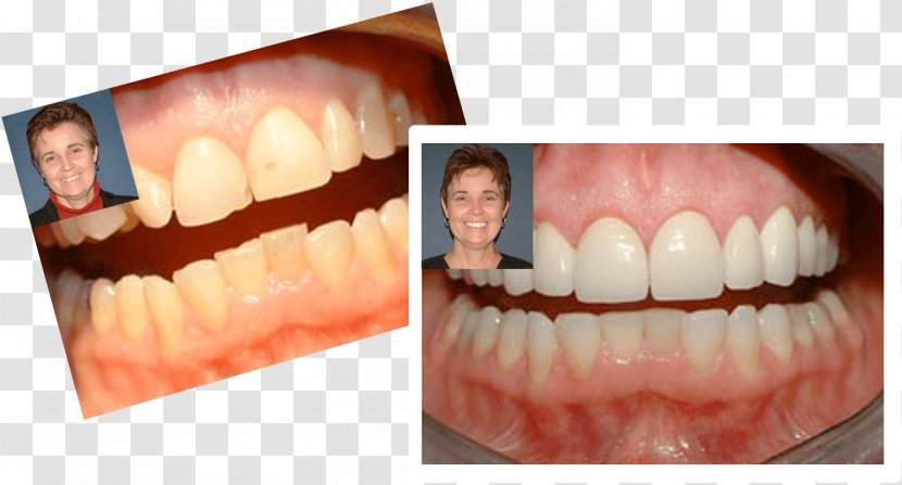 Markham, Dr. Kevin M R. Markham DDS Dentist Unionville Tooth - Flower - Dental Smile Transparent PNG
