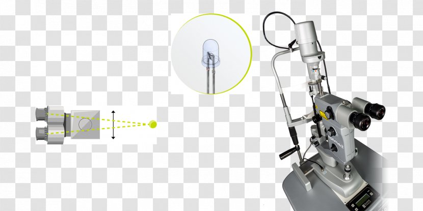 Nd:YAG Laser Capsulotomy Slit Lamp Iridectomy Photodisruption - Tool - Therapy Transparent PNG