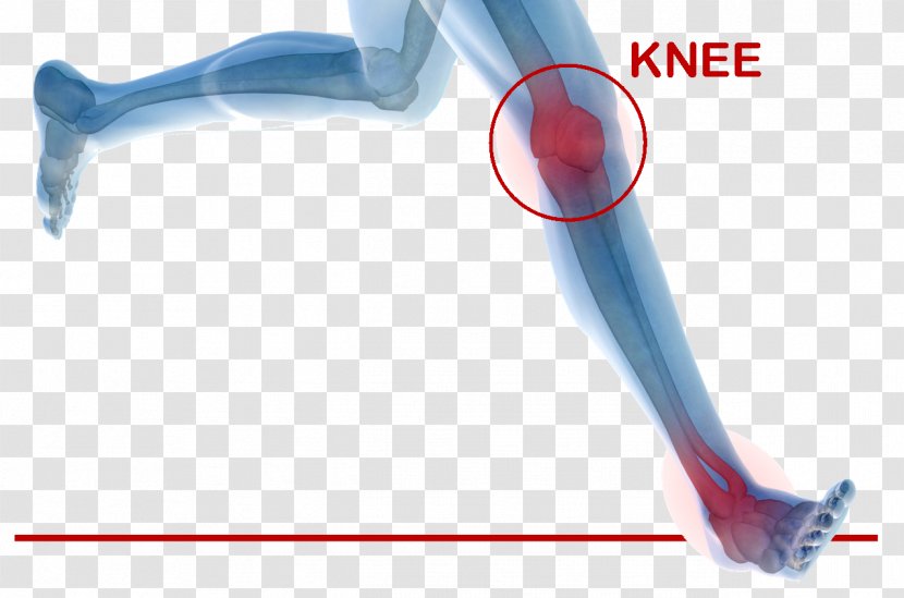 Orthopedic Surgery Knee Replacement Joint Therapy Transparent PNG