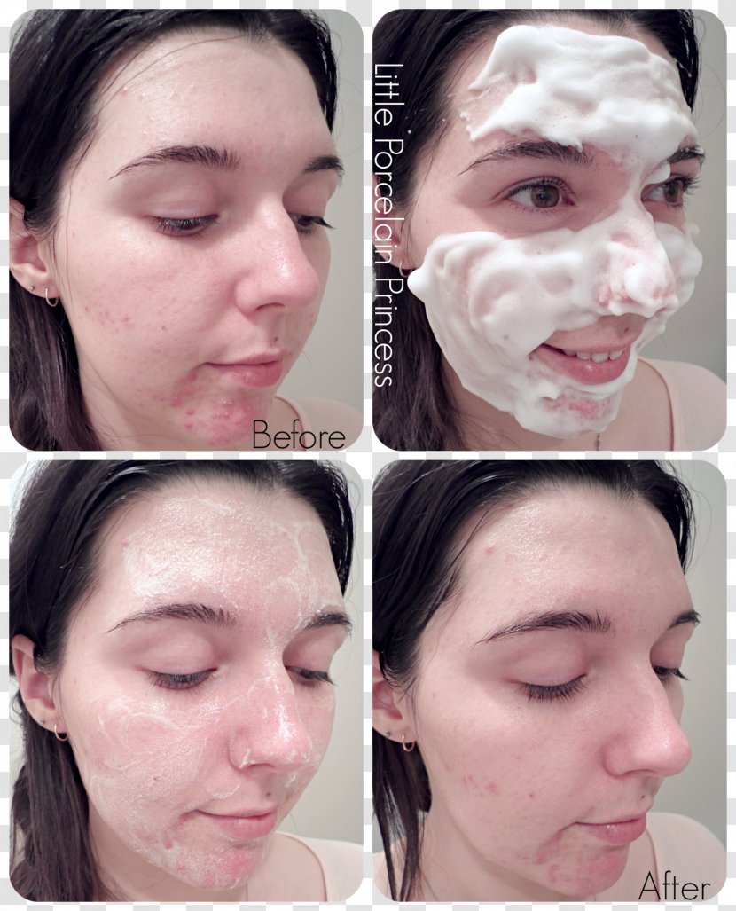 Cheek Mousse Egg Cream Face - Nose - Foam Transparent PNG