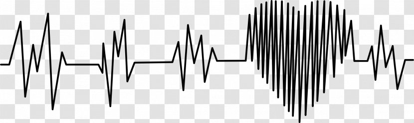 Electrocardiography Heart Rate Cardiovascular Disease Medicine - Electrocardiogram Transparent PNG
