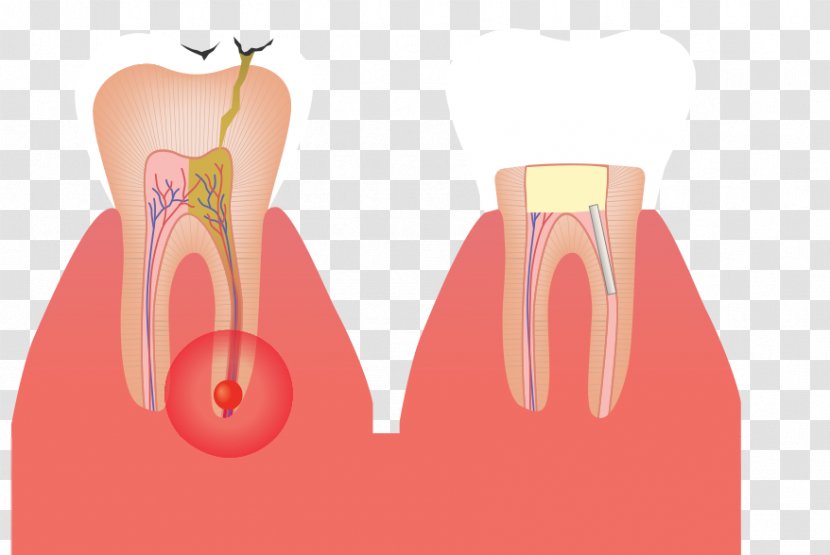 Shoulder Tooth Root Canal Gross Anatomy - Frame Transparent PNG