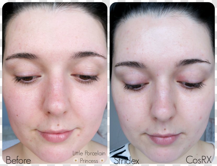 COSRX One Step Pimple Clear Facial Pad Acne Beta Hydroxy Acid Stridex Maximum - Eyelash Transparent PNG