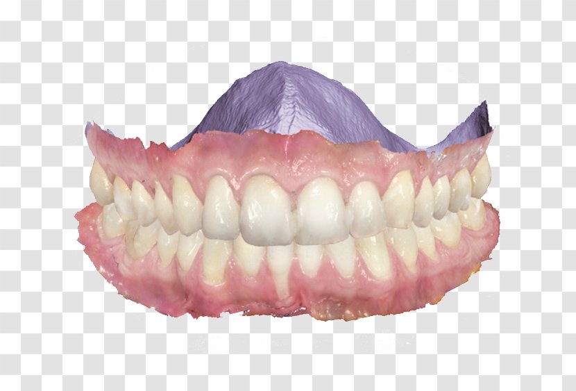 Image Scanner Dentistry 3Shape Patient - Dentist - Divider Transparent PNG