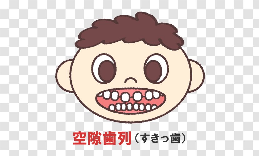 歯科 【 Muramatsu Dentistry Clinic 】 Ashiyashi Correction Shika Shinbishika Yoboshika Pediatric Dental Braces - Malocclusion - Caption Transparent PNG