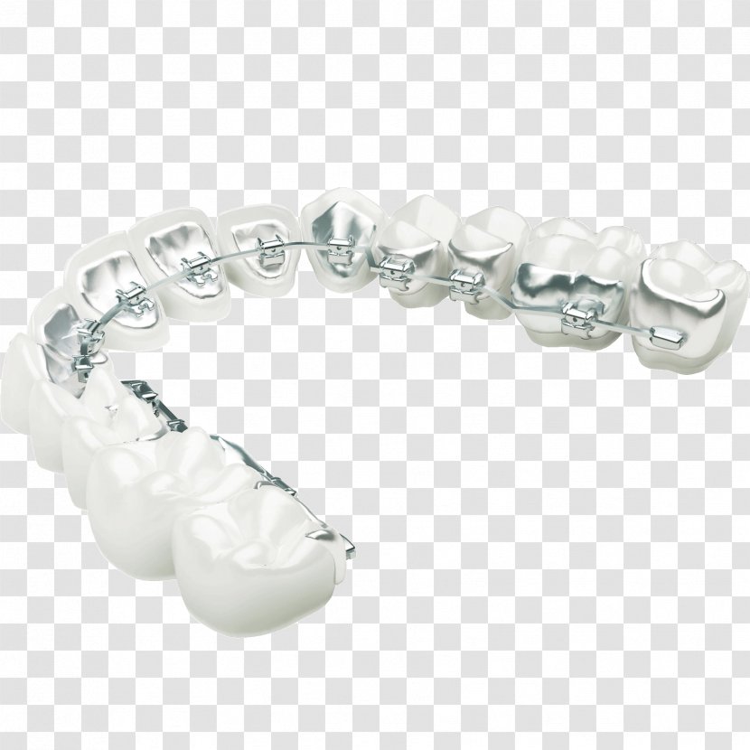 Lingual Braces Orthodontics Dental Clear Aligners Orthodontic Technology - Body Jewelry Transparent PNG