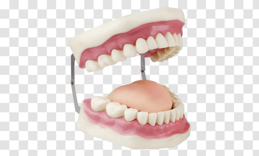 Dentures Dentistry Dental Instruments Human Tooth Implant - Laboratory Transparent PNG