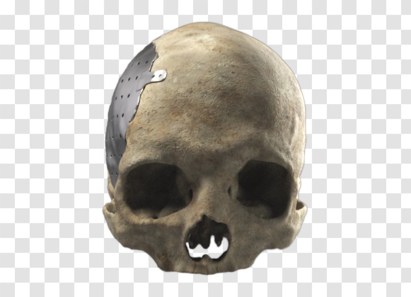 Cranioplasty Poly Skull Snout Skeleton - Jaw Transparent PNG
